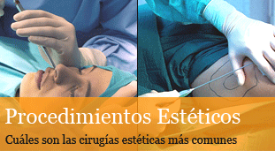 antes y despues de una liposucccion
