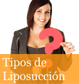 tipos de liposuccion