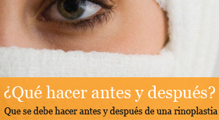 antes y despues de una rinoplastia