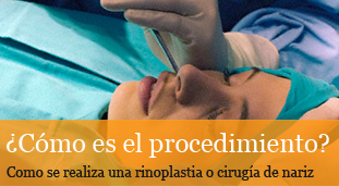 como se hace la rinoplastia